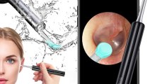 Bebird Earwax Removal Endoscope @ Kshs 5,000 only